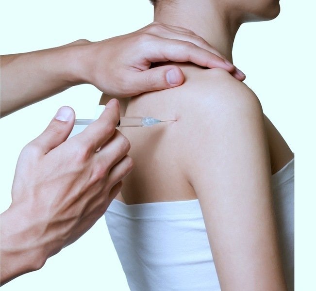 injection,shoulder,pain,bursitis